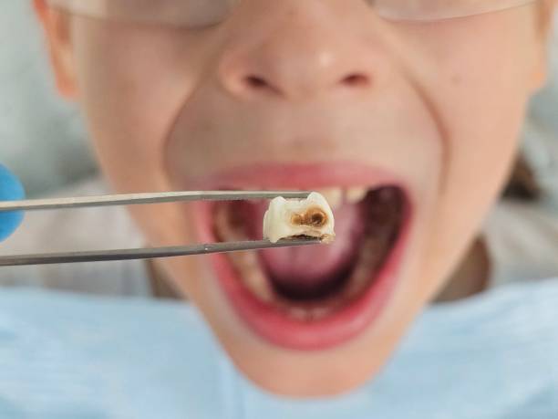 Best Urgent Dental Care for Toothaches in Hackleburg, AL